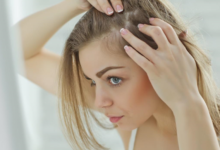 SMP Hairline: The Ultimate Solution for Hair Loss Confidence