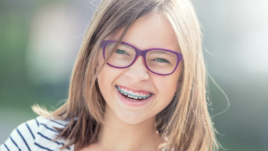 Is It Time for Braces? A Complete Guide to Knowing When to Start