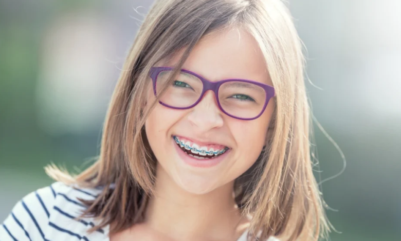 Is It Time for Braces? A Complete Guide to Knowing When to Start